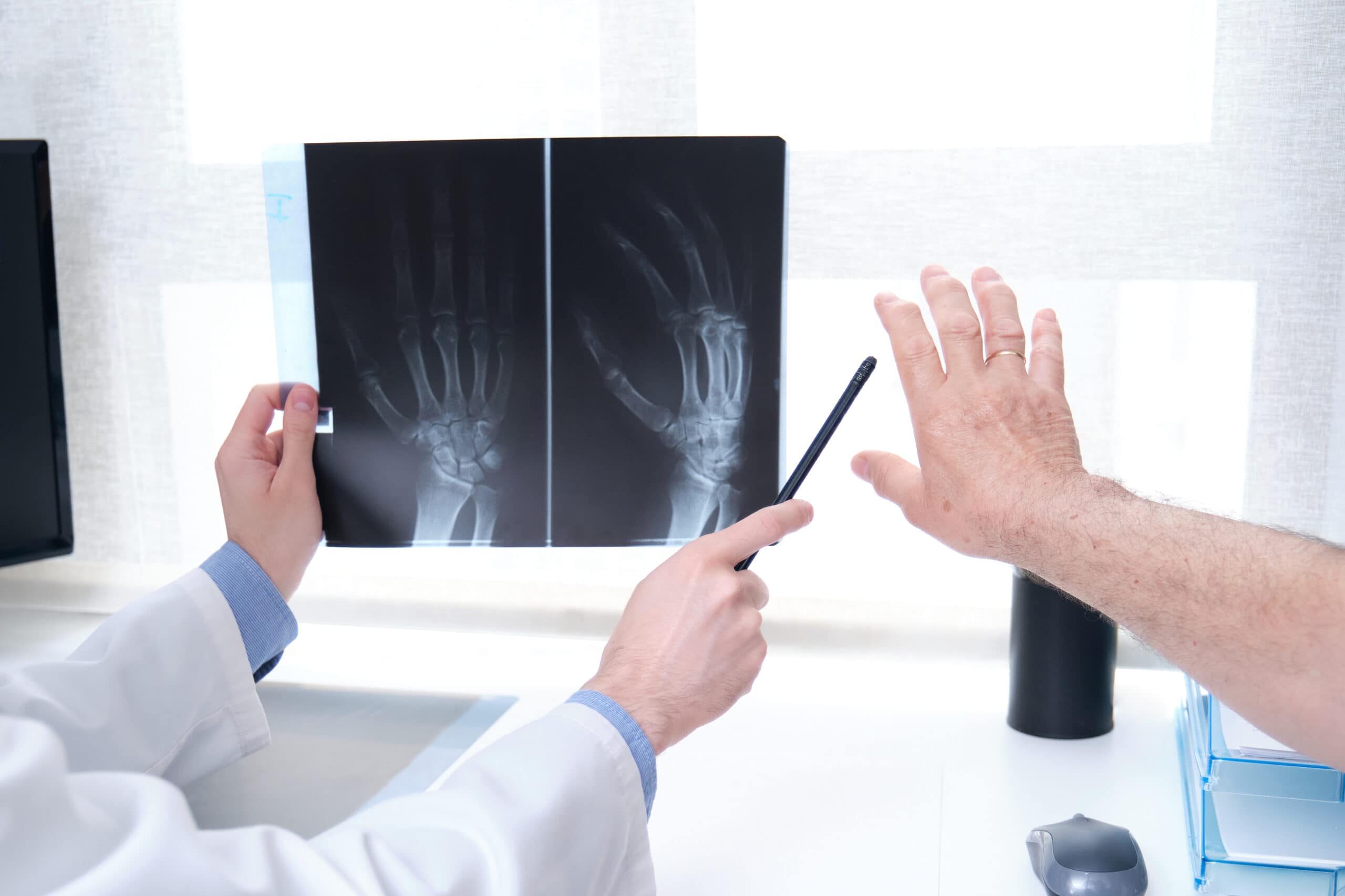 diagnostik-rheumatoiden-arthritis