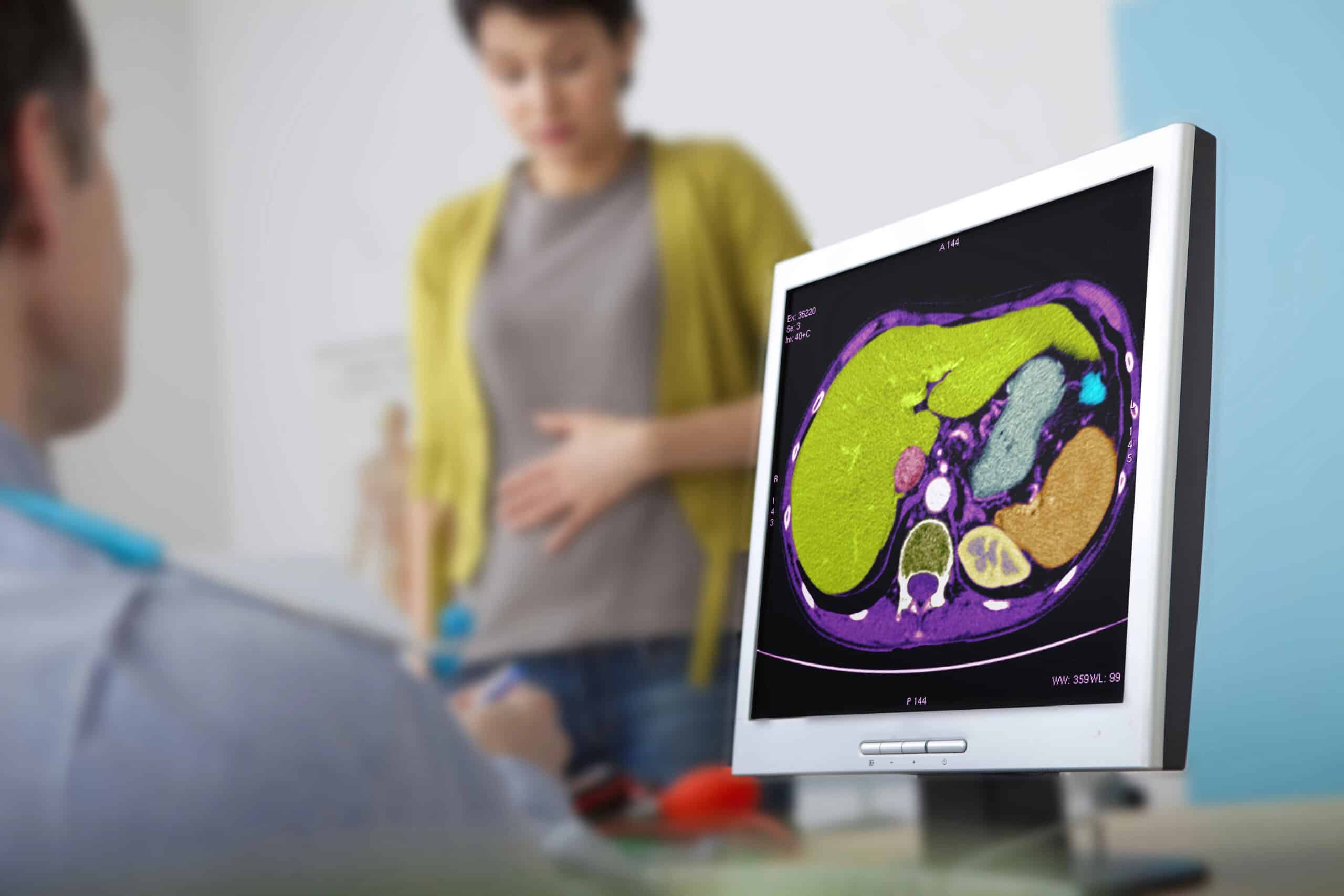 erkennung-lebererkrankungen-ultraschall-ct-mrt